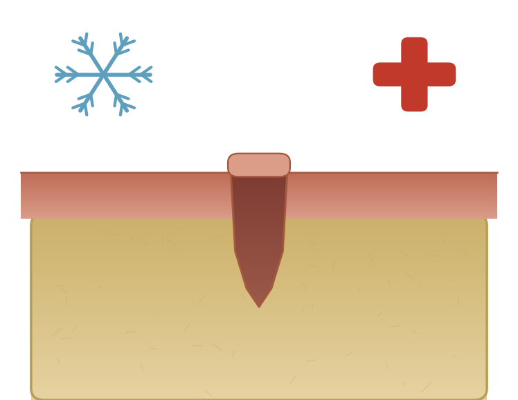 Illustration: Caring for your mouth after oral surgery