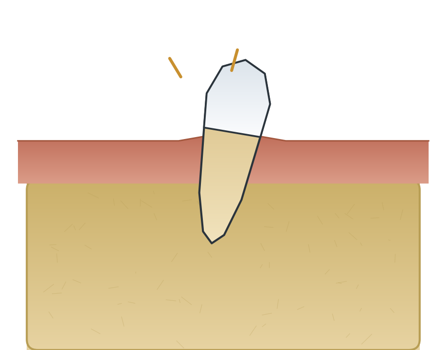 Illustration: Injury to a baby tooth