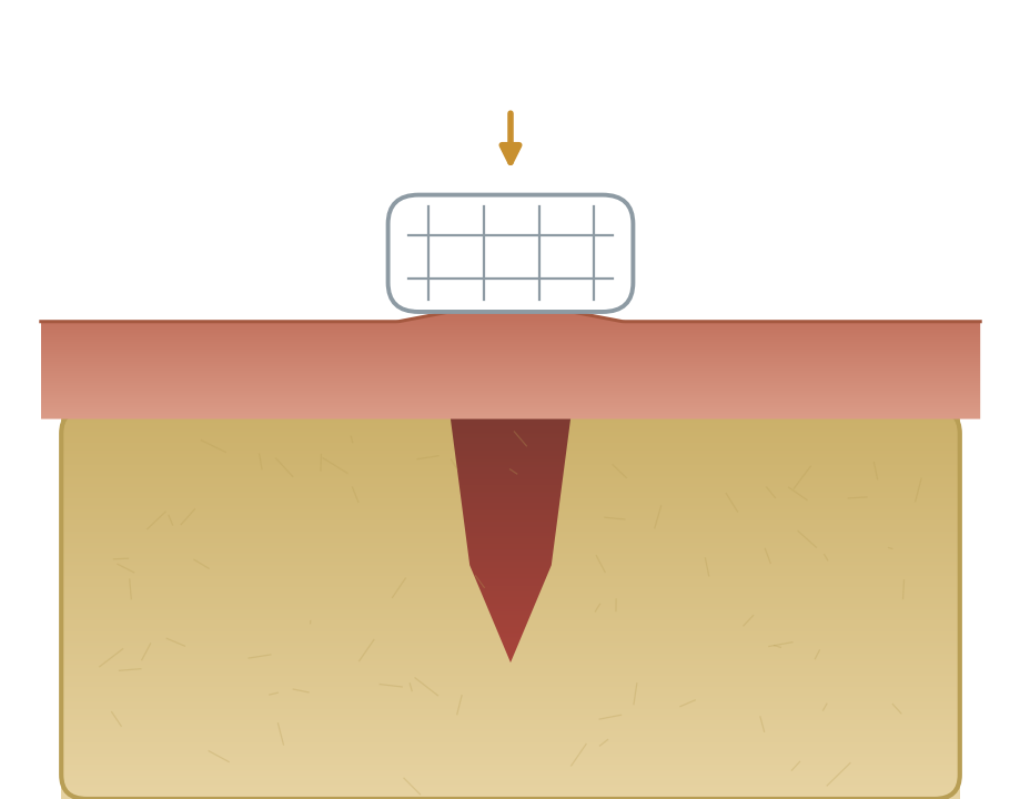 Illustration: Bleeding after an extraction