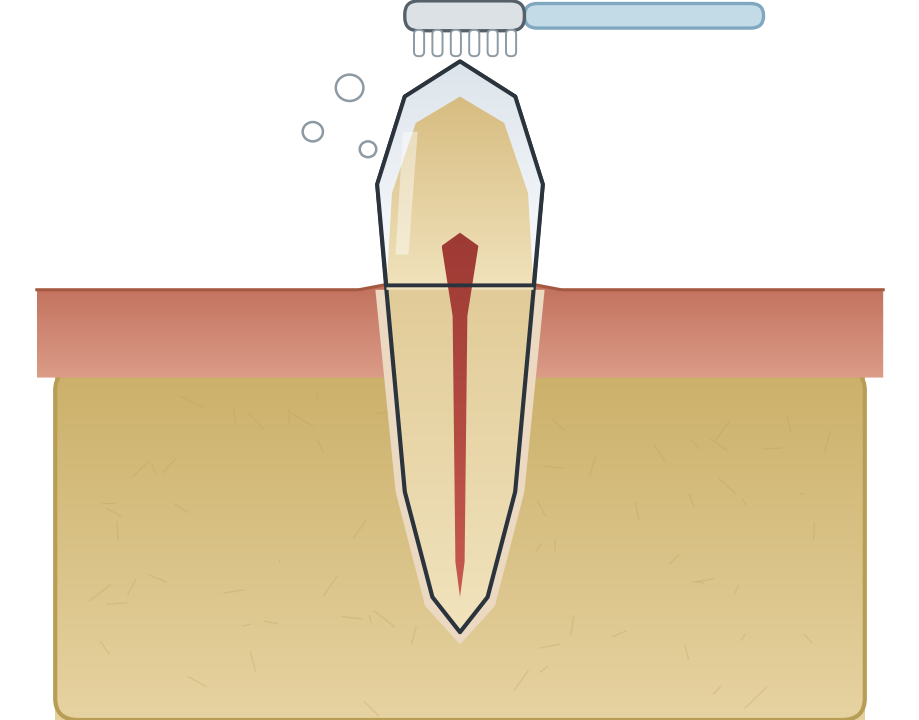 Illustration: Brushing technique