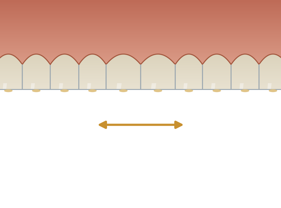 Illustration: Bruxism (grinding & clenching)