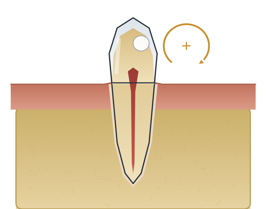 Illustration: Can a cavity heal itself?