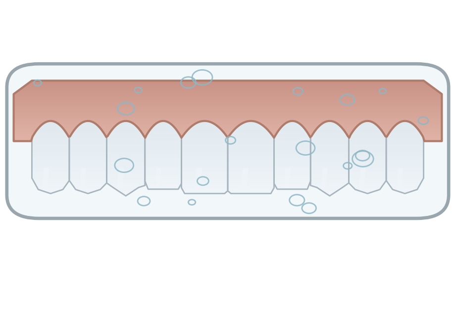 Illustration: Caring for your denture