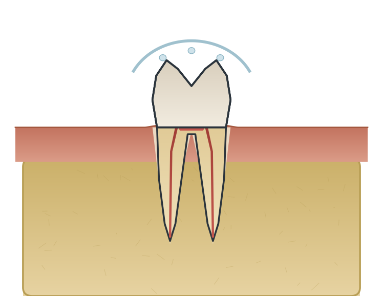 Illustration: Caring for new & temporary restorations