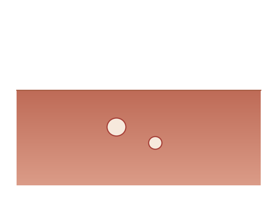 Illustration: Children's mouth sores