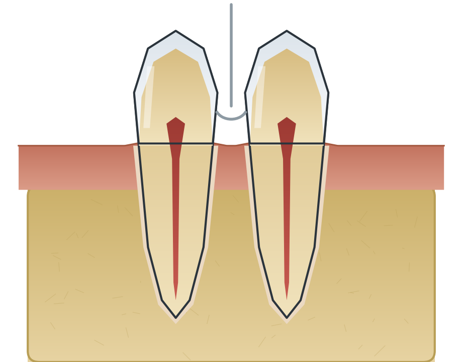 Illustration: Flossing & interdental cleaning