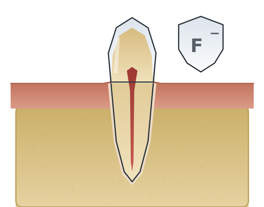 Illustration: Fluoride