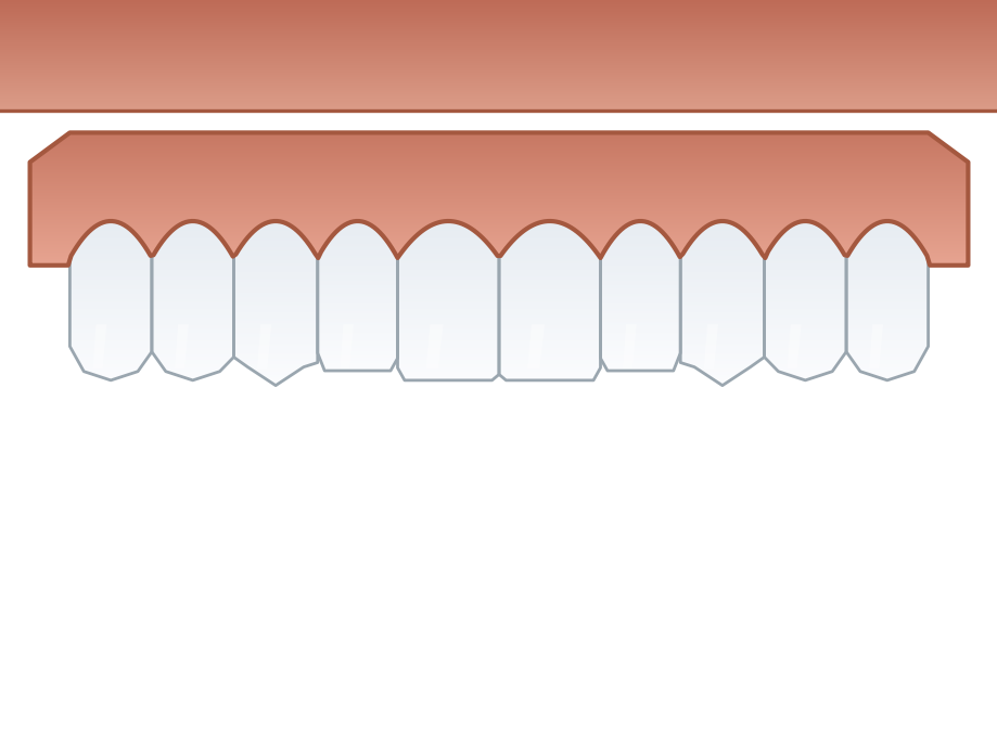 Illustration: Immediate dentures