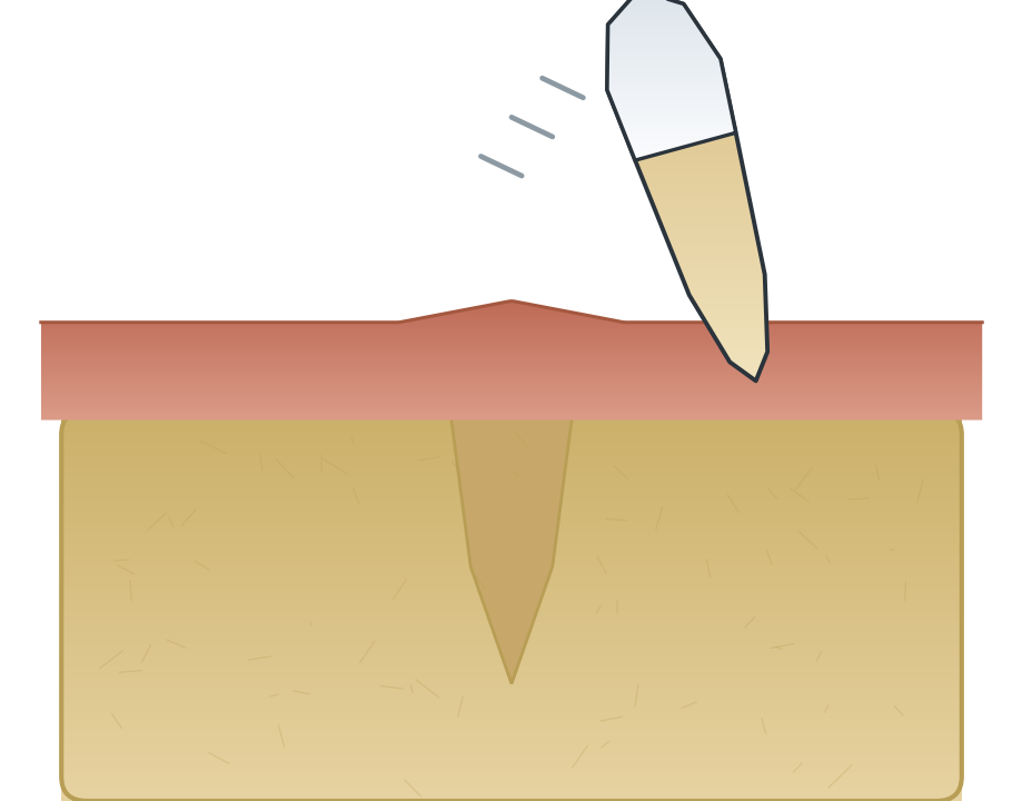 Illustration: Knocked-out (avulsed) tooth