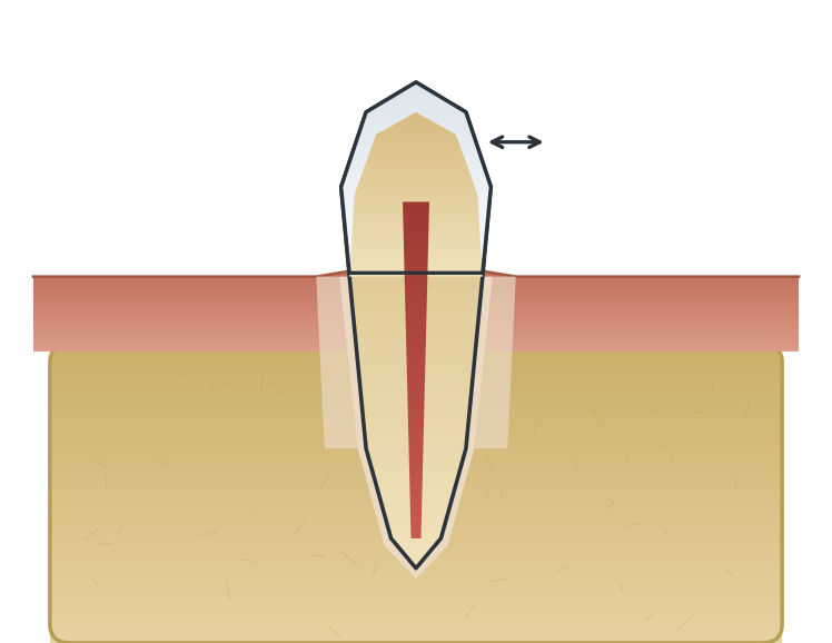 Illustration: Loose tooth