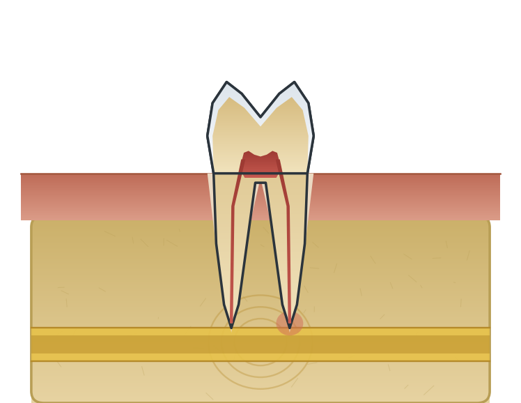 Illustration: Numbness after local anaesthetic