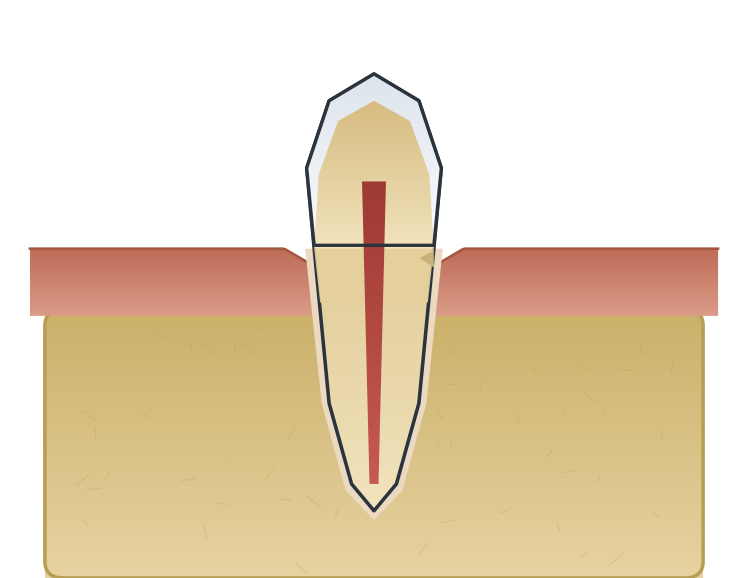 Illustration: Receding gums