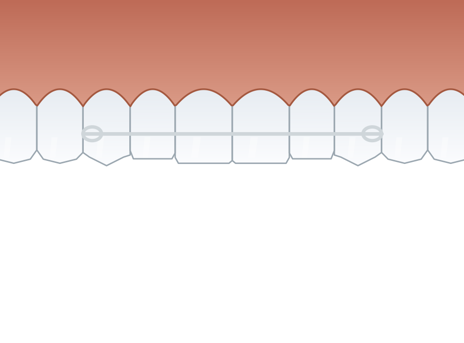 Illustration: Retainers