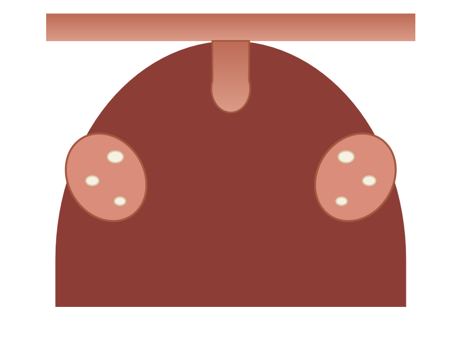 Illustration: Tonsil stones