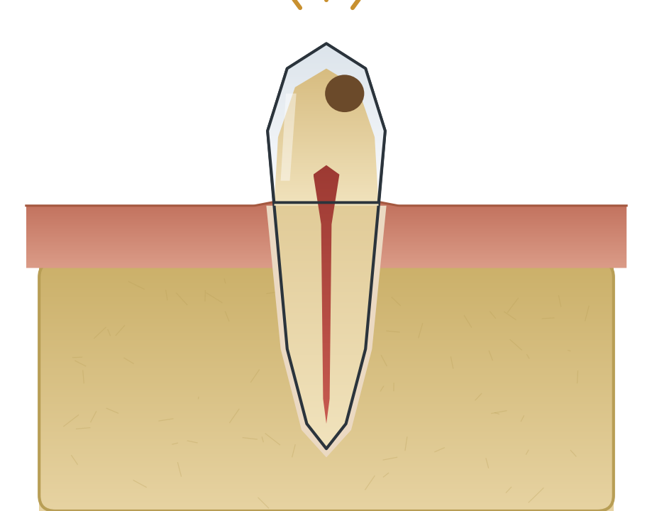 Illustration: Toothache