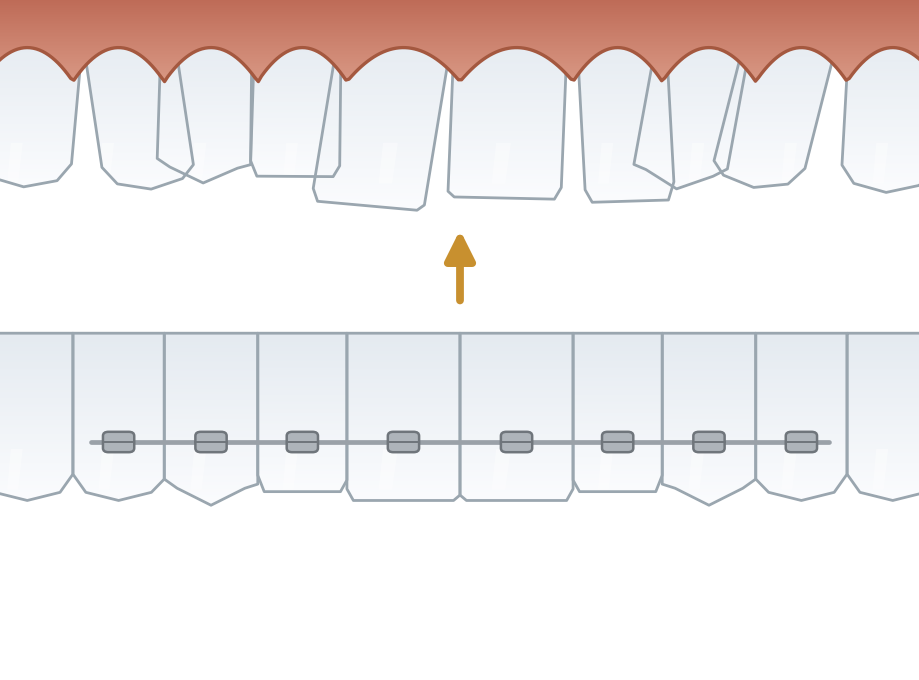 Illustration: Why orthodontics?